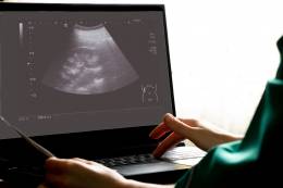 El proyecto ALISSE se enfoca en la salud de los astronautas de la ESA