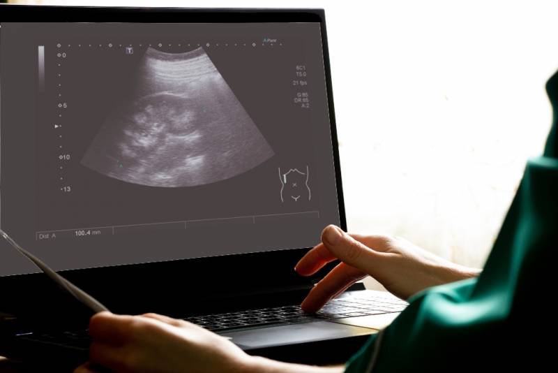 El proyecto ALISSE se enfoca en la salud de los astronautas de la ESA